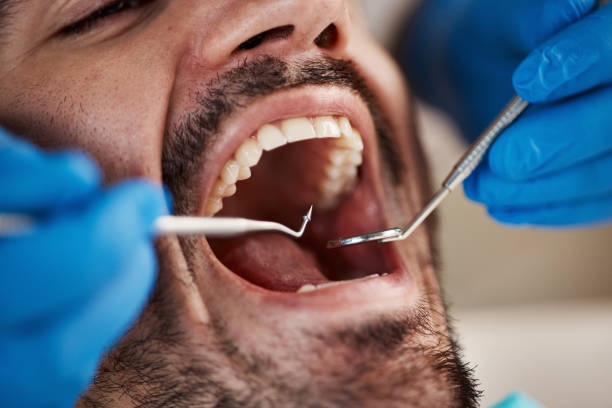Emergency Dental Services in Tiger Point, FL
